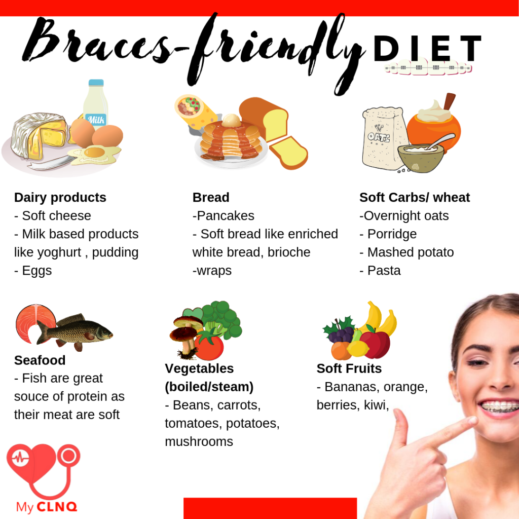 Braces Diet Plan : List of braces-friendly food